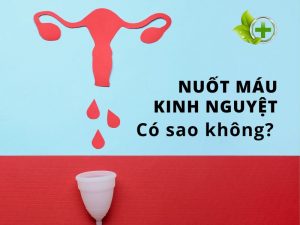 nuot-mau-kinh-nguyet-co-sao-khong