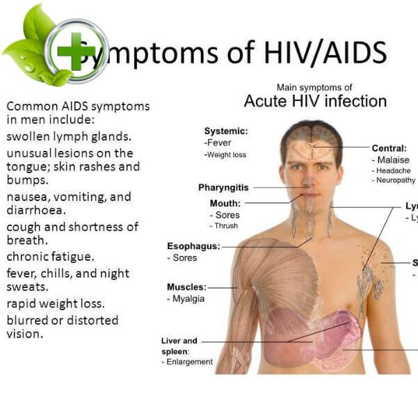 bệnh tưa miệng hiv 3