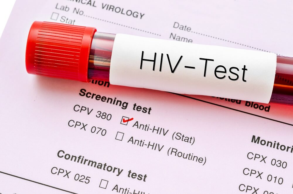 xét nghiệm anti hiv có chính xác không 3